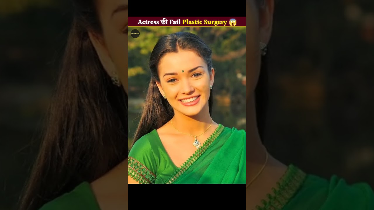 Failed Plastic Surgery Of Popular Celebrity 🤯😱 