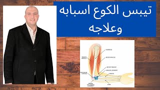 تيبس الكوع اسبابه وعلاجه للدكتور احمد العطار