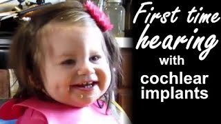 Deaf Baby Hears for the First Time with Cochlear Implants
