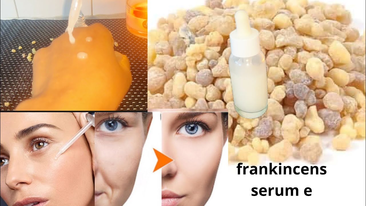 Frankincense Anti aging serum ku qurxi wajiga wax yabo dabici ah serum laga sameye foox ama luban