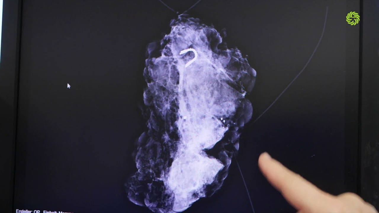 Breast Health Center Goldenes Kreuz Private Hospital