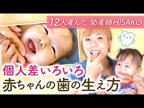 個人差いろいろ赤ちゃんの歯の生え方