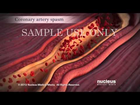 acute-coronary-syndrome-and-heart-attack