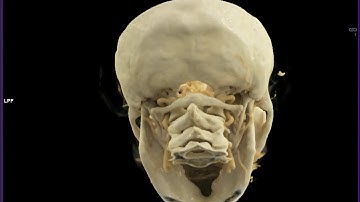 C-Spine with Cinematic Rendering