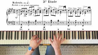 Ravina - Etudes Artistiques, Op. 83 No. 3
