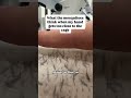 قرب يده من البعوض 😳!