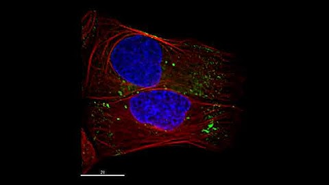Endosomal transport along microtubules