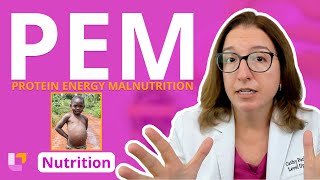 Protein Energy Malnutrition (PEM): Nursing School Nutrition Essentials Education | @LevelUpRN