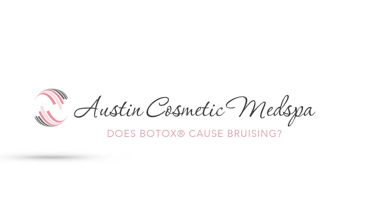 DOES BOTOX® CAUSE BRUISING?
