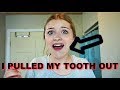 I PULLED MY FRONT TOOTH OUT