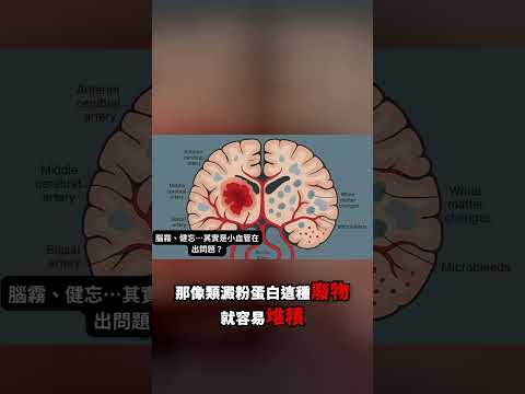 腦部廢物清除系統（膠淋巴系統和iPad系統）在睡眠時運作的迷人科學