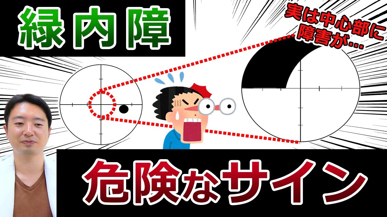 【緑内障】危険なサイン‼