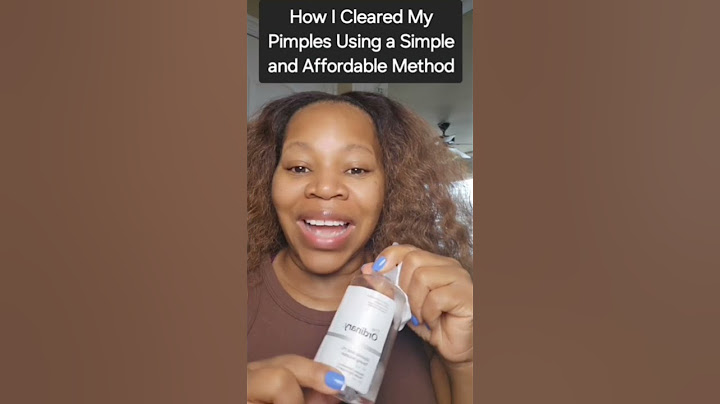 How I CLEARED My Pimples. #shorts #shortfeed #viral