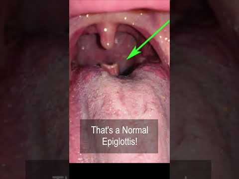 Video: Este epiglotica un cuvânt?