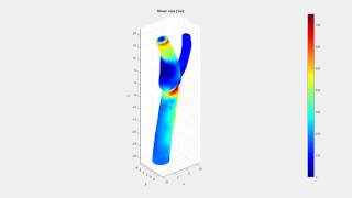 QuickerSim CFD Toolbox - Carotid Flow