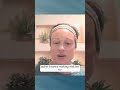 From suffering to supporting others! #lupus #alopecia #integrativehealing