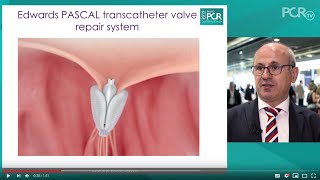 Advances in mitral repair therapy with the PASCAL device - EuroPCR 2019
