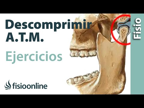 Video: 4 formas de tratar el trastorno de la articulación temporomandibular (TMD) con ejercicios para la mandíbula