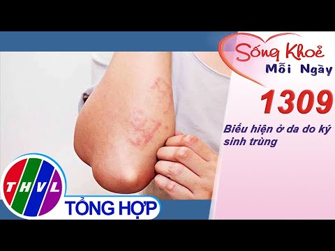 Video: Dấu hiệu nhiễm ký sinh trùng ở mèo