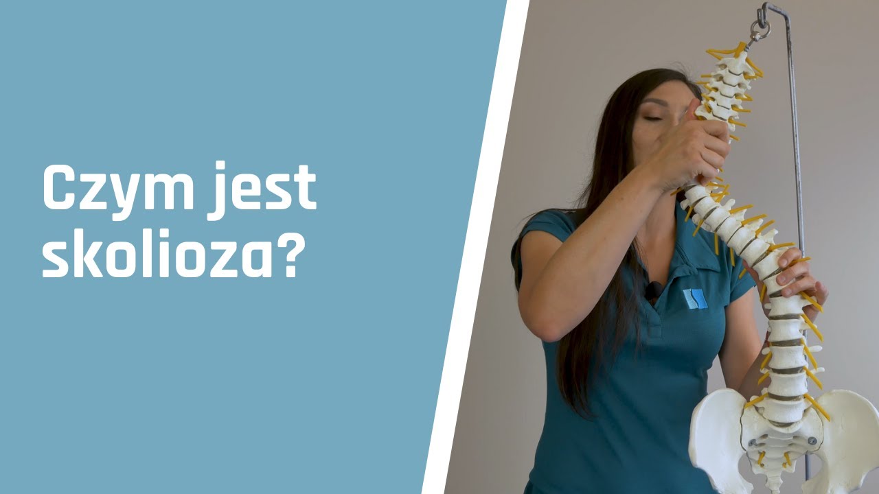 Czym jest skolioza?