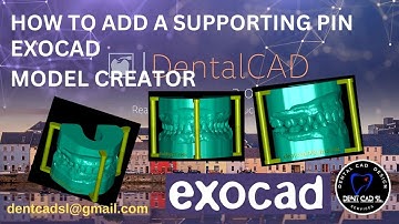 exocad model creator supporting pins