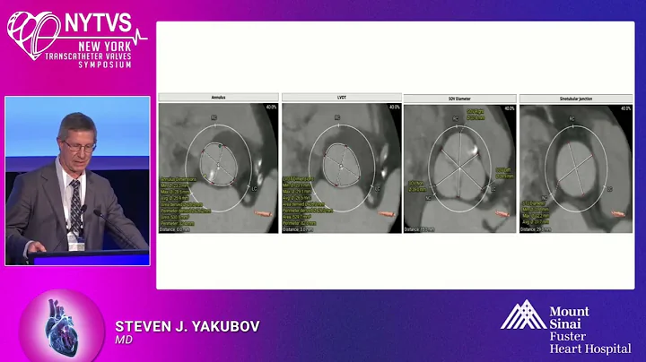 Beware of the Caveat of Early TAVR - Steven J  Yakubov, MD