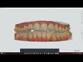 Ortho model slicing discussion 10-10-2024