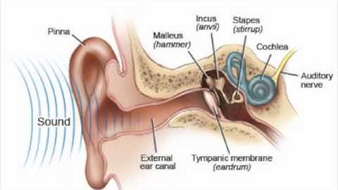 Auditory Neuropathy Spectrum Disorder Simulation