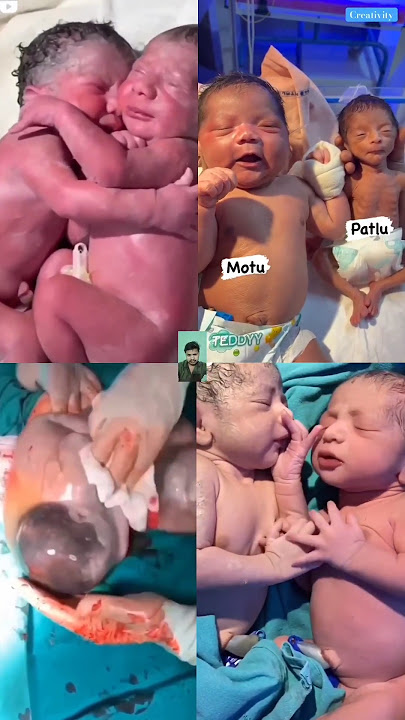 twins baby good morning !! part 12 !! 😍🥰 #shorts #cute #cutebaby