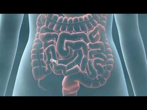 Капсульная эндоскопия в медицинском центре Водников