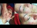 Estetica Tutorial: Trattamento viso detossinante e rimpolpante