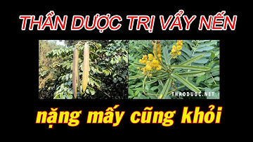 Cây thuốc trị vẩy nến rất đơn giản, ai cũng có thể kiếm được - Thaoduoc.Net