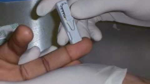 HIV test results in 20 minutes