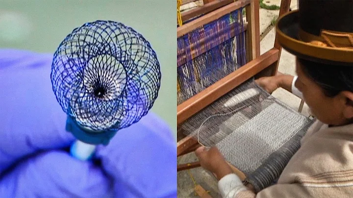 A new way to heal hearts without surgery | Franz F...
