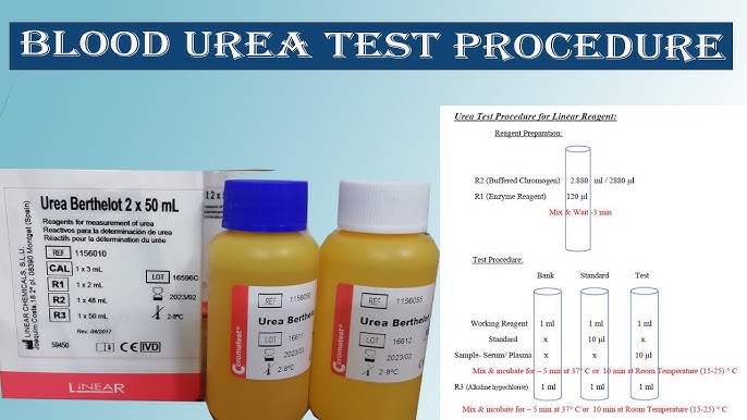 Serum Uric Acid Test in Bangla / How to calibration serum Uric