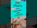🔥Как убрать наплыв над коленом#shorts #отёки_ног#leg_edema#knee#lympho_stasis