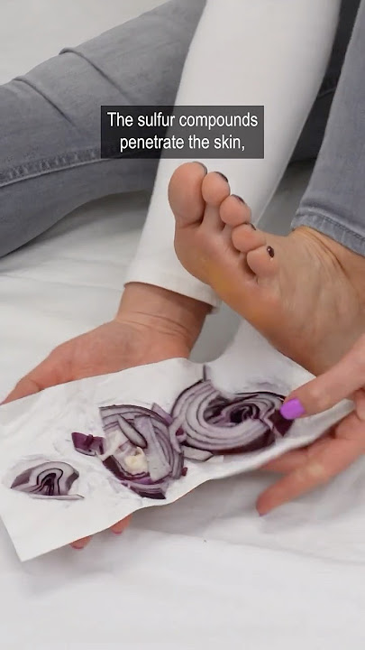 Place sliced onion on your feet and forget about the pharmacy