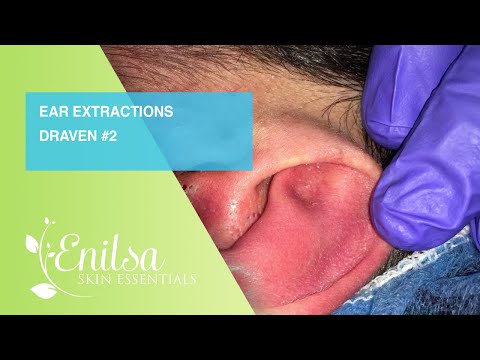 Ear Extractions on Draven