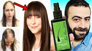 احذر نيو هير لوشن يدمر شعرك و صحتك ولا يعالج الصلع الوراثي او تساقط الشعر - Neo Hair Lotion