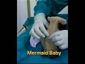 Effect of Diabetes in Pregnancy