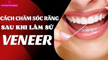 Hướng dẫn chăm sóc răng sau khi dán veneer | Tt niềng răng quốc tế Diamond