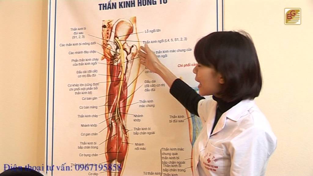Triệu chứng và cách điều trị bệnh đau dây thần kinh tọa – BS.Nguyễn Thị Ngọc