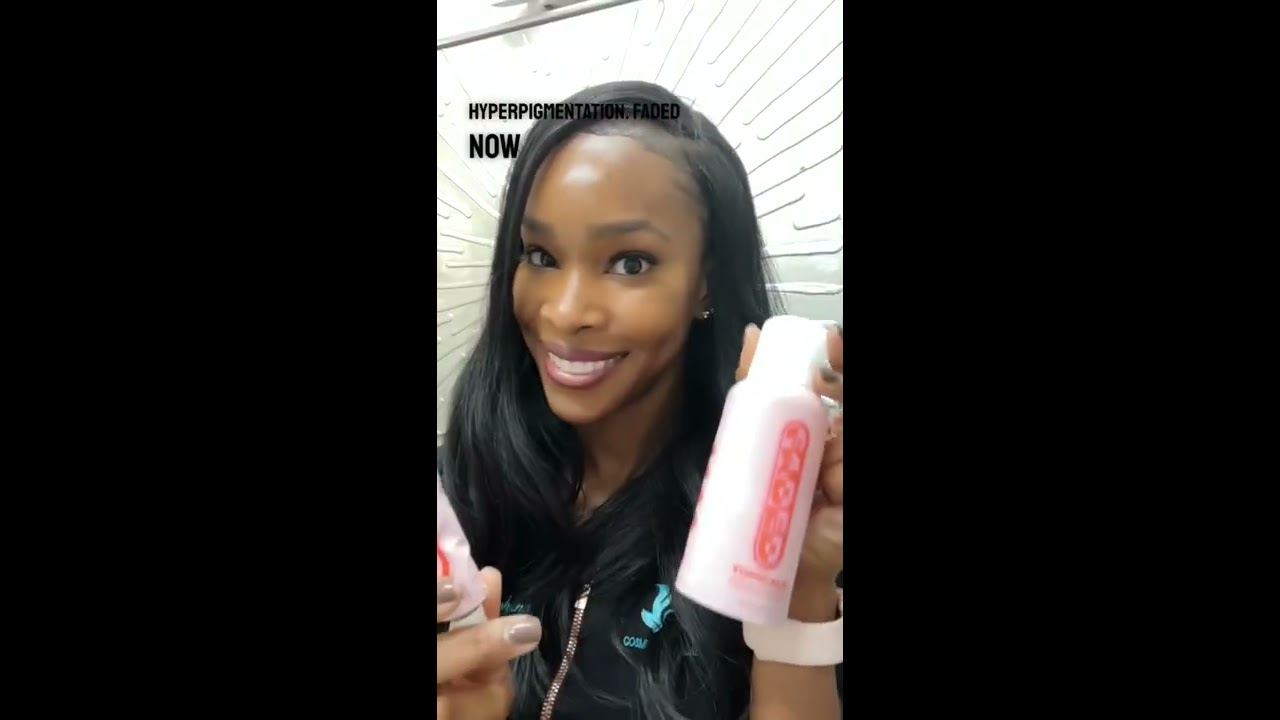 5 Favorite Products For Dark Spots And Hyperpigmentation