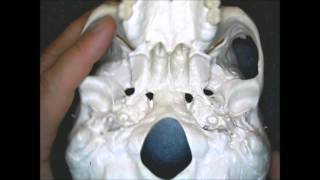 Lacrimal, Vomer And Palatine Bones