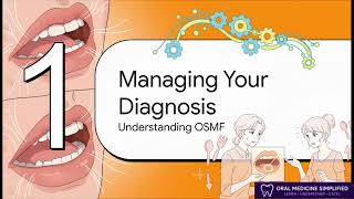 Oral Submucous Fibrosis (OSMF) Treatment: Exercises, Physiotherapy, Steroids & Home Management