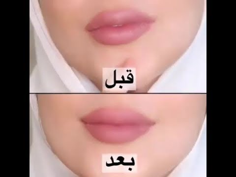 طريقة تحويل اي روج عادي الى مات