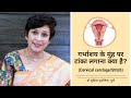 बच्चेदानी/गर्भाशय के मुंह पर टांका लगाना क्या है?| Cervical cerclage/Stitch | Dr Supriya Puranik