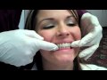 Abari Orthodontics HAwley retainer delivery by Dr. WIll