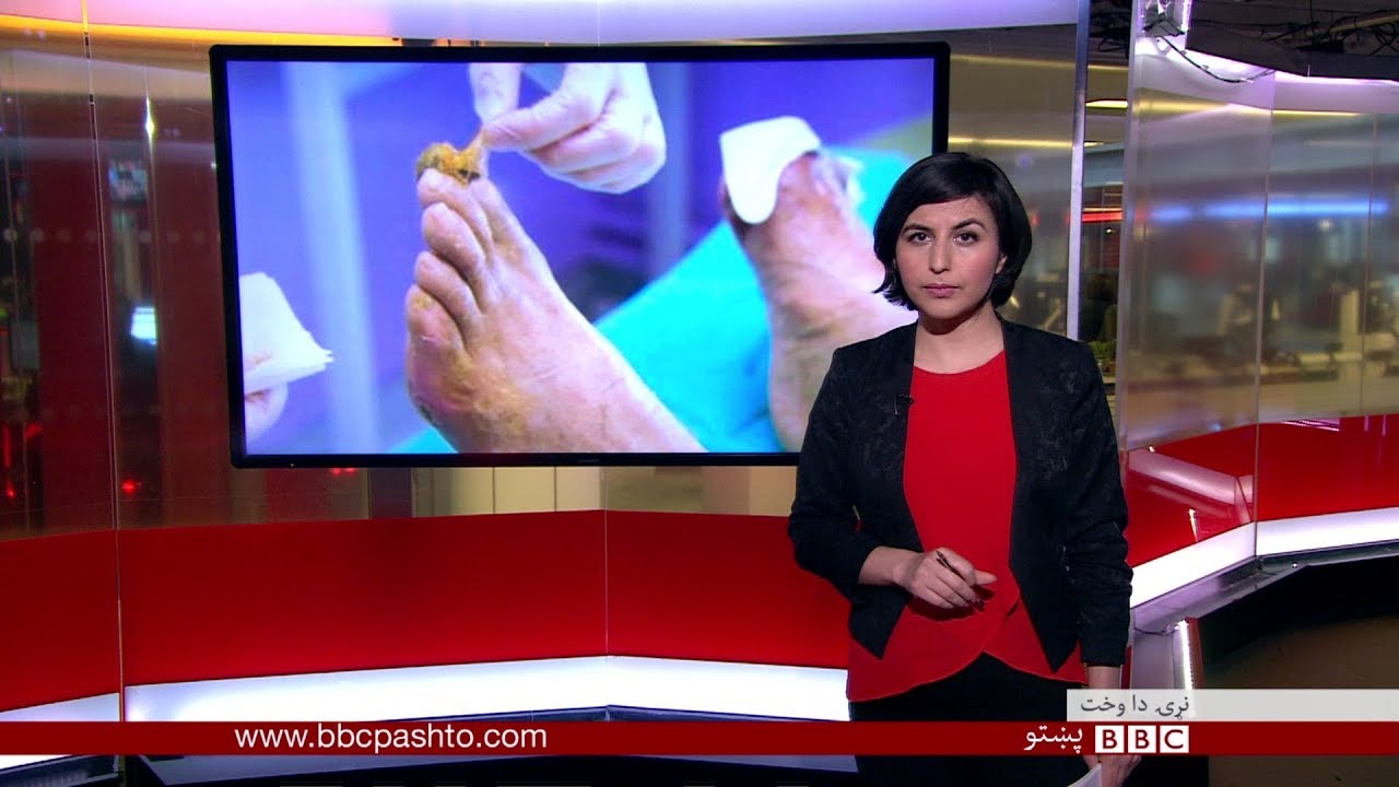 BBC Pashto TV, Naray Da Wakht: 17 Nov 2017