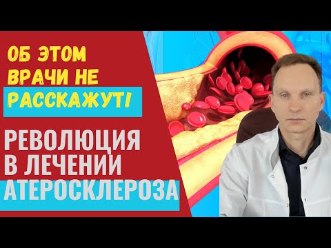 Революция в лечении атеросклероза. О чем молчат врачи